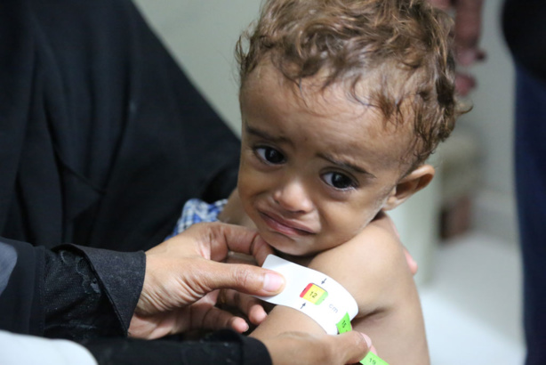 Crise au Yémen : L'ONU demande une aide urgente afin d'éviter une catastrophe