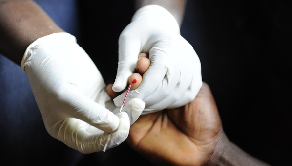 ONUSIDA, ASLM et ses partenaires lancent une initiative pour améliorer le diagnostic du VIH ONUSIDA, ASLM et ses partenaires lancent une initiative pour améliorer le diagnostic du VIH
