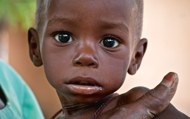 Conséquences de la malnutrition : Le Sénégal perd annuellement 500 millions de FCFA à cause de la malnutrition, selon la FAO Conséquences de la malnutrition : Le Sénégal perd annuellement 500 millions de FCFA à cause de la malnutrition, selon la FAO
